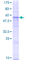 12.5% SDS-PAGE Stained with Coomassie Blue.
